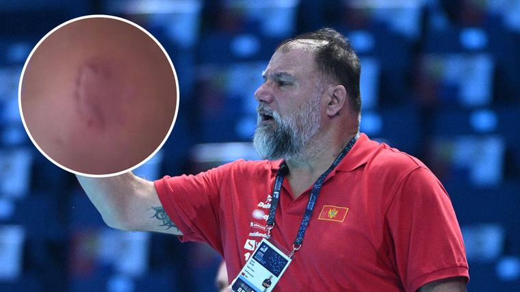 Italijan ujeo Danila Stupara u finalu Mediteranskih igara: Sudija isključio