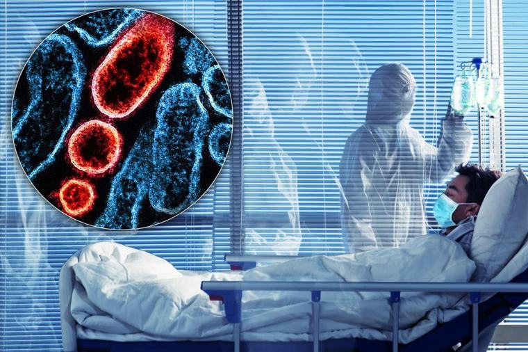 POTVRĐEN SMRTONOSNI VIRUS U ZAGREBU! Četiri osobe u bolnici, dve na intenzivnoj: Pronađeni zaraženi prenosioci, stručnjak otkriva jedini spas!