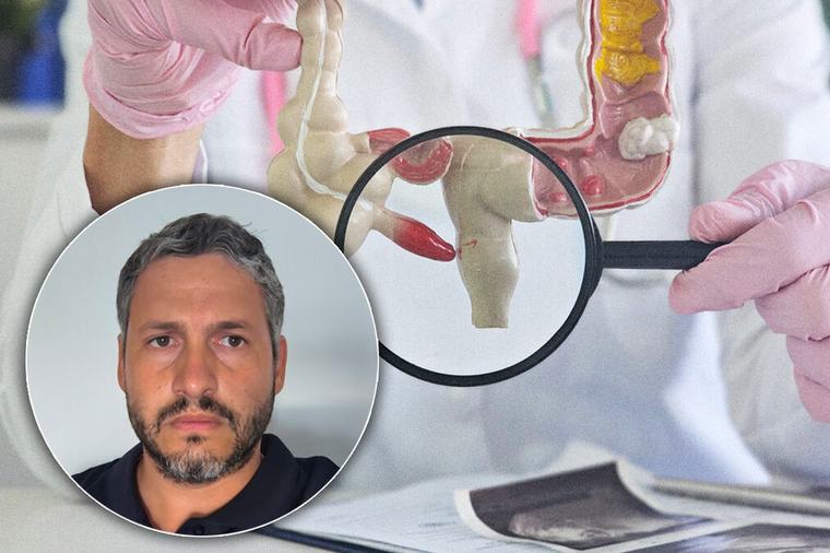 Koliko brzo može da pukne slepo crevo? Hirurg otkriva simptome zbog kojih ne smete da čekate