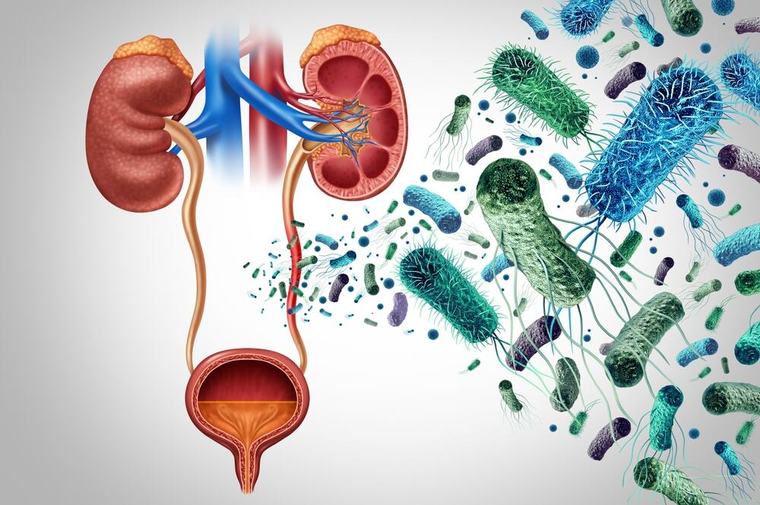 Zašto se urinarne infekcije vraćaju i posle antibiotika: Mikro-bešika i sićušni virusi donose nadu
