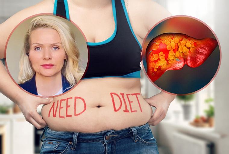 Masna jetra, salo na stomaku i visoki trigliceridi: Nutricionista upozorava
