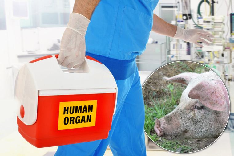 Svinjski bubreg ispisao istoriju transplantacije: Pacijent 9 meseci živeo bez dijalize, a zatim dobio ljudski organ